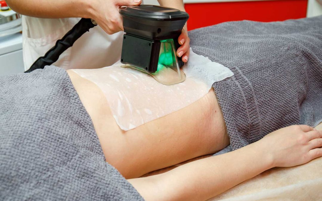 Fat Freezing? Facts About CoolSculpting