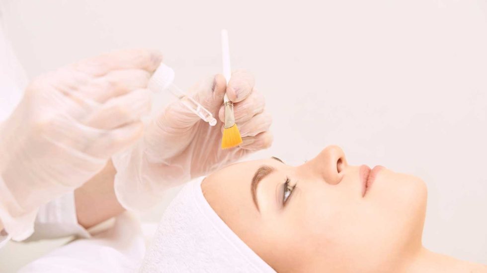Sunspots-With-Facial-Peels