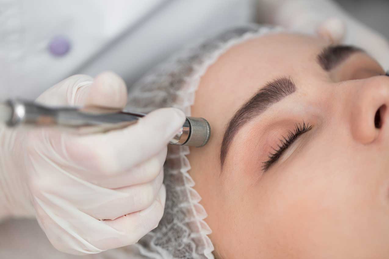 Facial-Peelings