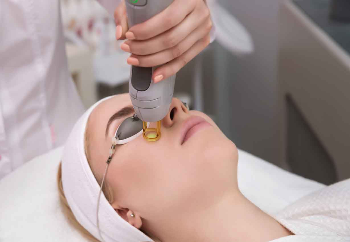 Upper-Lips-removal-services