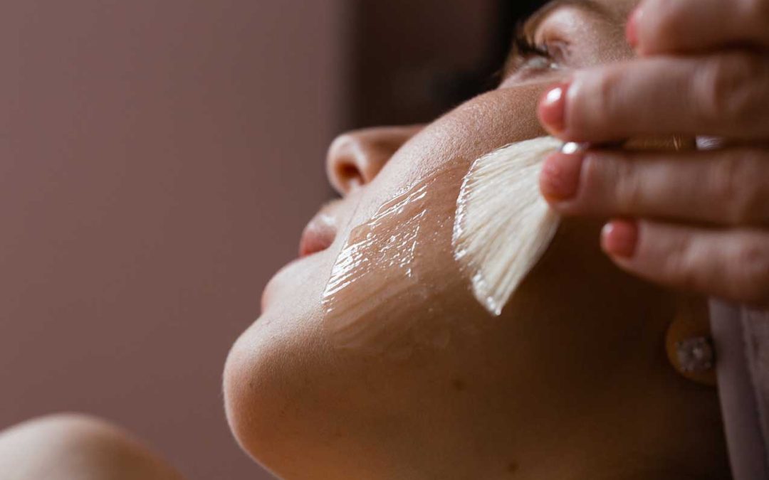 How To Prepare for Vi Peel