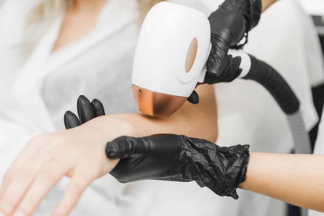 Home Laser Hair Removal